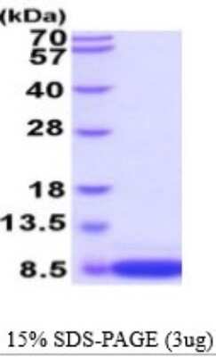 SDS-PAGE: Recombinant Mouse S100B Protein [NBP2-53070]