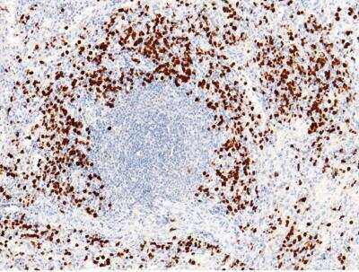 Immunohistochemistry-Paraffin: S100P Antibody (116) [NBP2-90135]