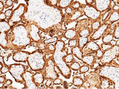 Immunohistochemistry-Paraffin: S100P Antibody (116) [NBP2-90135]