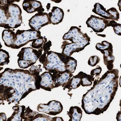 Immunohistochemistry-Paraffin: S100P Antibody [NBP1-89541]