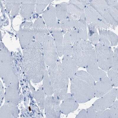 Immunohistochemistry-Paraffin: S100P Antibody [NBP1-89541]