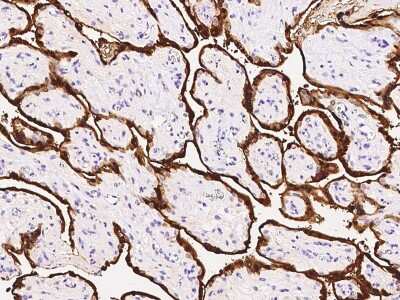 Immunohistochemistry-Paraffin: S100P Antibody [NBP2-99514]