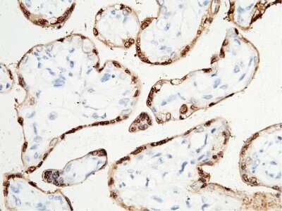 Immunohistochemistry-Paraffin: S100P Antibody [NBP3-00029]