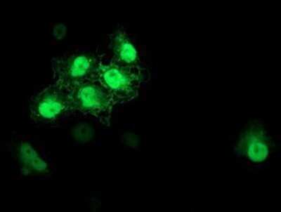 Immunocytochemistry/ Immunofluorescence: S100P Antibody (OTI1A4) - Azide and BSA Free [NBP2-73972]