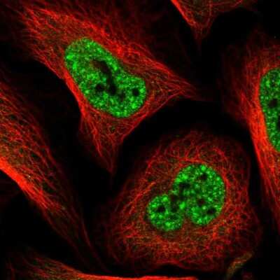 Immunocytochemistry/ Immunofluorescence: S100P binding protein Antibody [NBP2-48581]