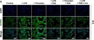 Immunocytochemistry/ Immunofluorescence: S1P1/EDG-1 Antibody [NB120-11424]