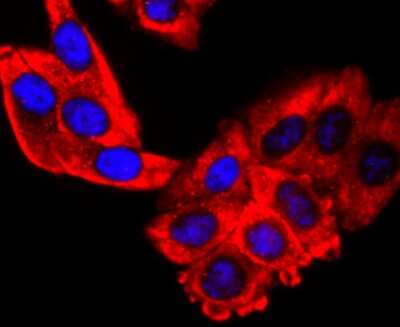 Immunocytochemistry/ Immunofluorescence: S1P1/EDG-1 Antibody (JM10-66) [NBP2-67129]