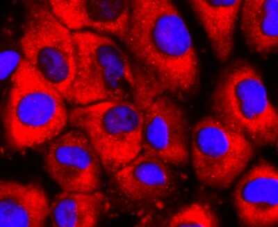 Immunocytochemistry/ Immunofluorescence: S1P1/EDG-1 Antibody (JM10-66) [NBP2-67129]