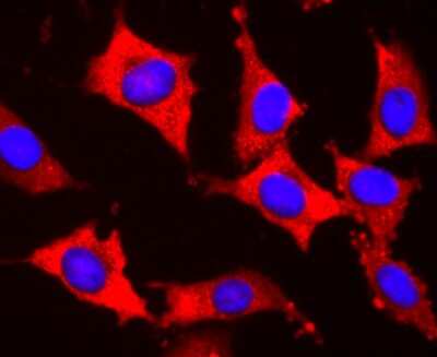 Immunocytochemistry/ Immunofluorescence: S1P1/EDG-1 Antibody (JM10-66) [NBP2-67129]