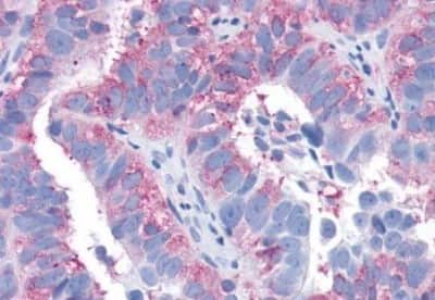 Immunohistochemistry-Paraffin: S1P3/EDG-3 Antibody [NBP3-14467]