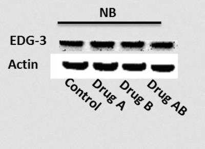 Western Blot: S1P3/EDG-3 Antibody [NBP2-24762]