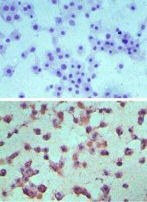 Immunohistochemistry-Paraffin: S1P4/EDG-6 Antibody - BSA Free [NBP2-24500]