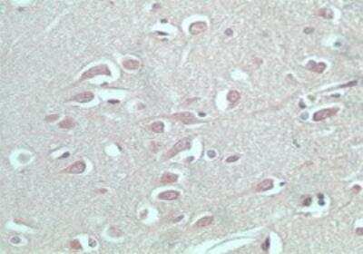 Immunohistochemistry-Paraffin: S1P5/EDG-8 Antibody [NBP2-24712]