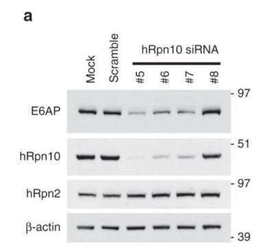 Knockdown Validated: S5a/Angiocidin Antibody [NBP2-19952]