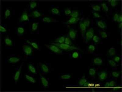 Immunocytochemistry/ Immunofluorescence: SA1 Antibody (2E9) [H00010274-M01]