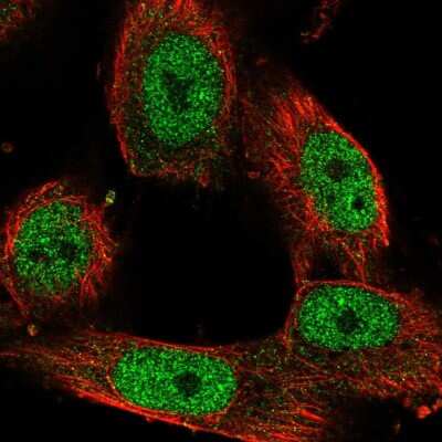 Immunocytochemistry/ Immunofluorescence: SA1 Antibody [NBP2-54976]