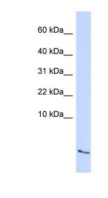 Western Blot: Serum Amyloid A4 Antibody [NBP1-58991]