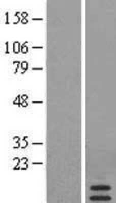 Western Blot: Serum Amyloid A4 Overexpression Lysate [NBL1-15673]