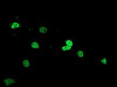 Immunocytochemistry/ Immunofluorescence: SAE2 Antibody (OTI4A3) [NBP2-03688]
