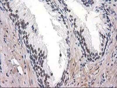 Immunohistochemistry-Paraffin: SAE2 Antibody (OTI4A3) [NBP2-03688]