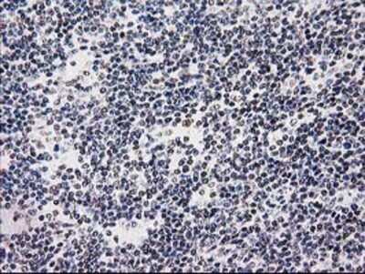 Immunohistochemistry: SAE2 Antibody (OTI4A3) - Azide and BSA Free [NBP2-73973]