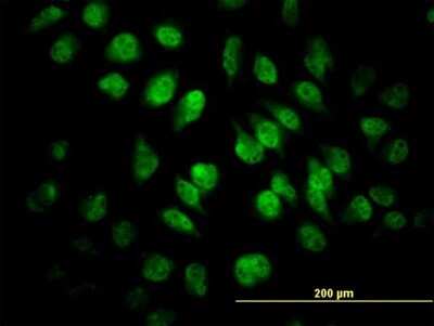 Immunocytochemistry/ Immunofluorescence: SAFB Antibody (5A11) [H00006294-M04]