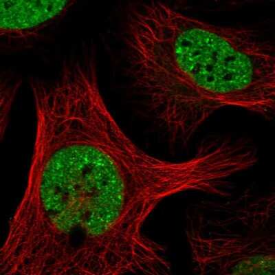 Immunocytochemistry/ Immunofluorescence: SAFB Antibody [NBP1-83265]