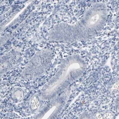 Immunohistochemistry-Paraffin: SAGE1 Antibody [NBP1-84354]