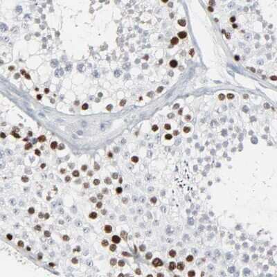 Immunohistochemistry-Paraffin: SAGE1 Antibody [NBP1-84354]