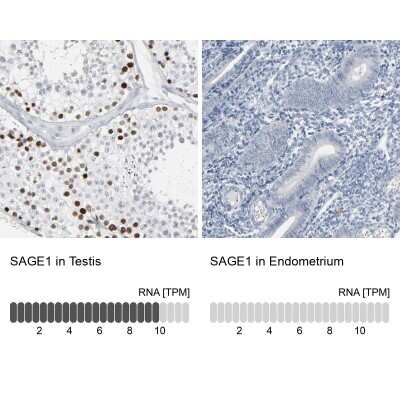 Immunohistochemistry-Paraffin: SAGE1 Antibody [NBP1-84354]