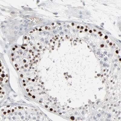 Immunohistochemistry-Paraffin: SAGE1 Antibody [NBP1-84355]