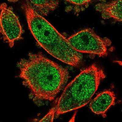 Immunocytochemistry/ Immunofluorescence: SAH3 Antibody [NBP2-47293]
