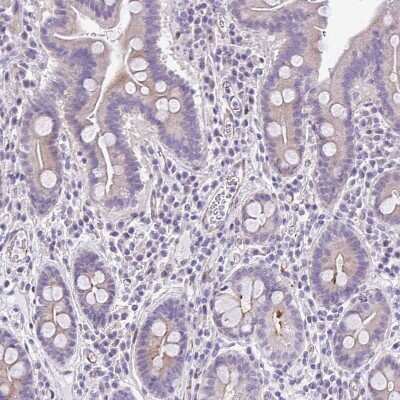 Immunohistochemistry-Paraffin: SAH3 Antibody [NBP2-47293]