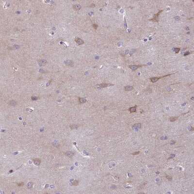 Immunohistochemistry-Paraffin: SAH3 Antibody [NBP2-47293]
