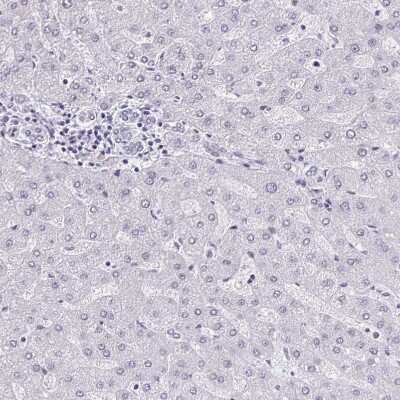 Immunohistochemistry-Paraffin: SAH3 Antibody [NBP2-47293]