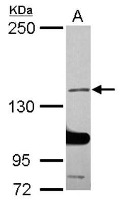 Western Blot: SALF Antibody [NBP2-20253]