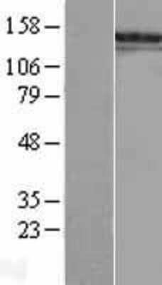 Western Blot: SALL1 Overexpression Lysate [NBL1-15678]