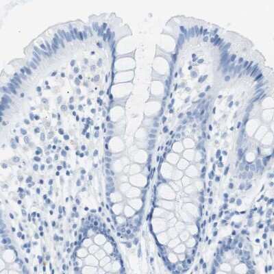 Immunohistochemistry-Paraffin: SALL4 Antibody [NBP1-85206]