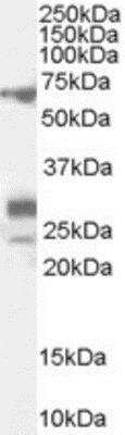 Western Blot: SALL4 Antibody [NB100-60559]