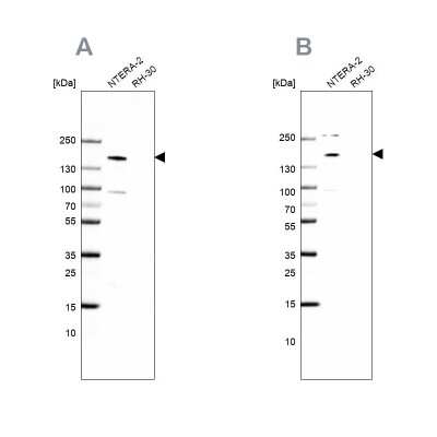 Western Blot: SALL4 Antibody [NBP1-85206]