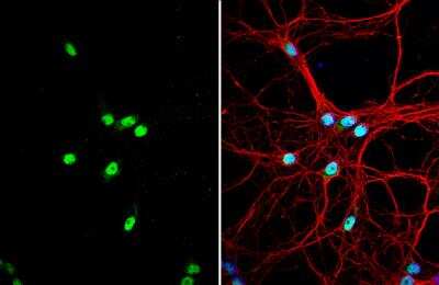Immunocytochemistry/ Immunofluorescence: SAM68 Antibody [NBP2-20254]