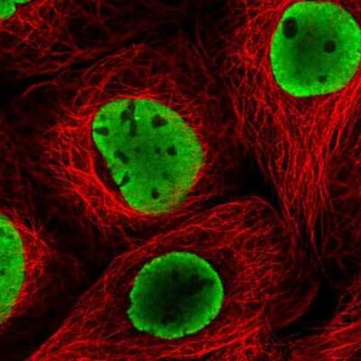 Immunocytochemistry/ Immunofluorescence: SAM68 Antibody [NBP2-38645]
