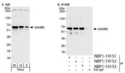 Western Blot: SAM68 Antibody [NBP1-19151]