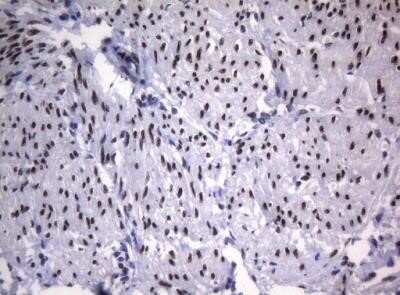 Immunohistochemistry: SAMD12 Antibody (OTI2G1) - Azide and BSA Free [NBP2-73974]