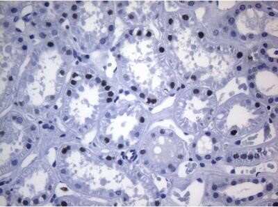 Immunohistochemistry: SAMD12 Antibody (OTI2G1) - Azide and BSA Free [NBP2-73974]