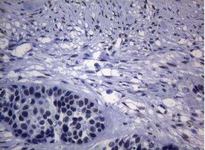 Immunohistochemistry-Paraffin: SAMD12 Antibody (OTI2G1) [NBP2-45684]
