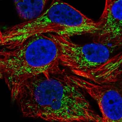 Immunocytochemistry/ Immunofluorescence: SAMD13 Antibody [NBP2-31734]