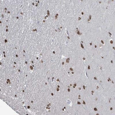 Immunohistochemistry-Paraffin: SAMD14 Antibody [NBP2-13278]