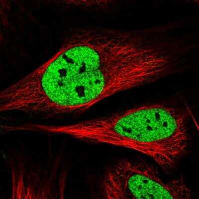 Immunocytochemistry/ Immunofluorescence: SAMD15 Antibody [NBP1-90726]
