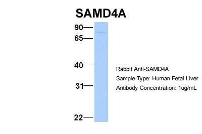 Western Blot: SAMD4A Antibody [NBP1-57597]